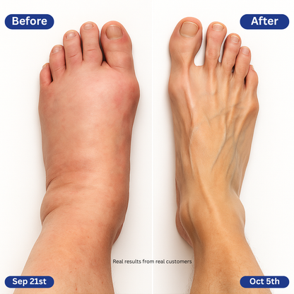 SoleSoother™-Neuropathy Foot Circulation Relief